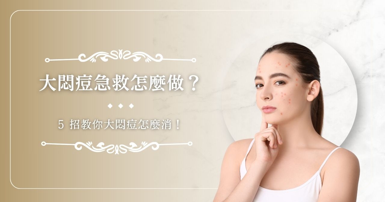 大悶痘急救怎麼做？ 5 招教你大悶痘怎麼消！