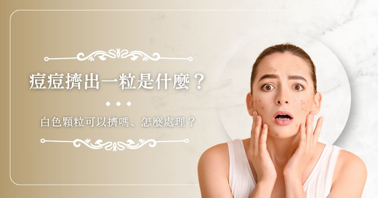 痘痘擠出一粒是什麼？白色顆粒可以擠嗎、怎麼處理？