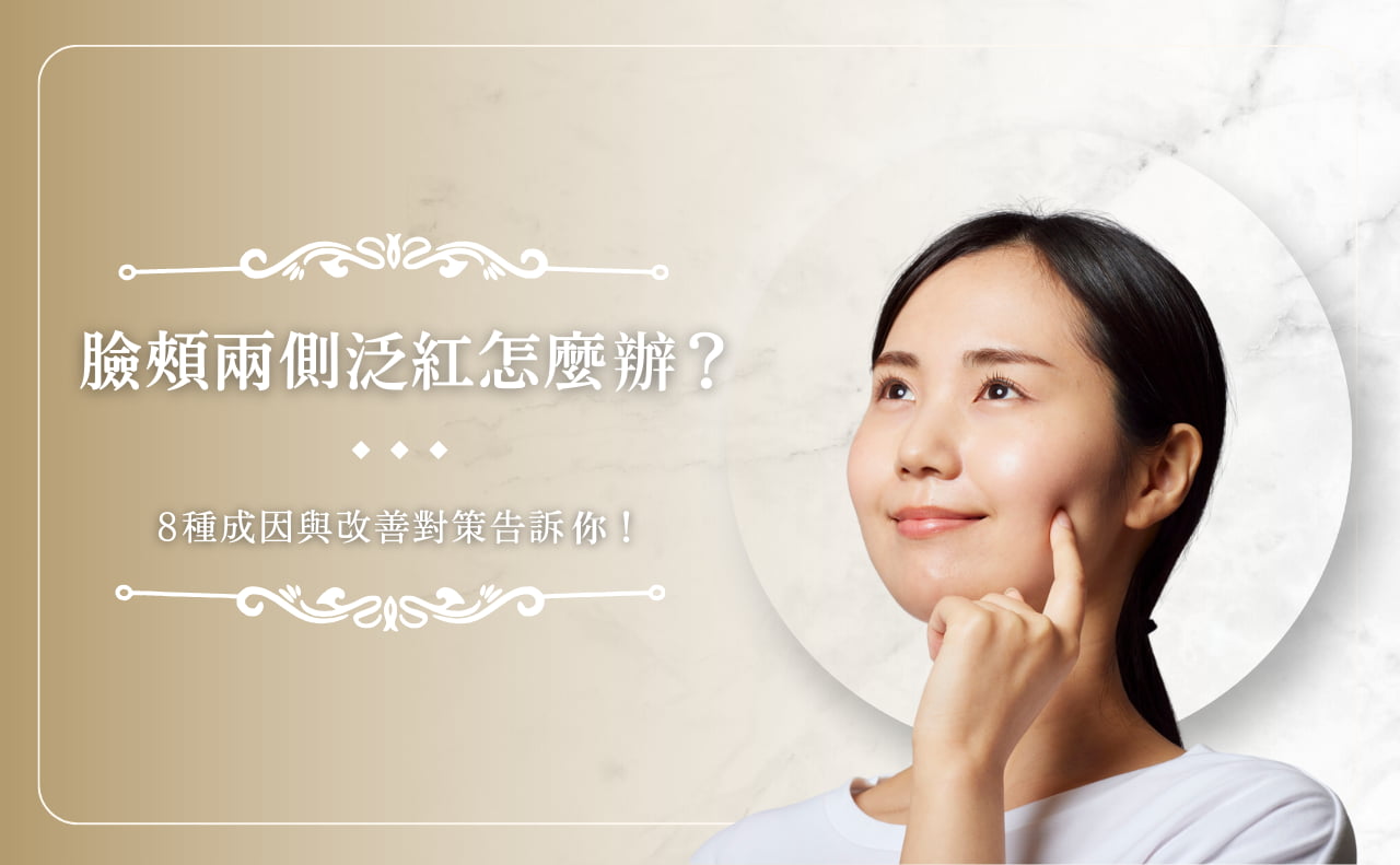 臉頰兩側泛紅怎麼辦？ 8 種成因與改善對策告訴你！